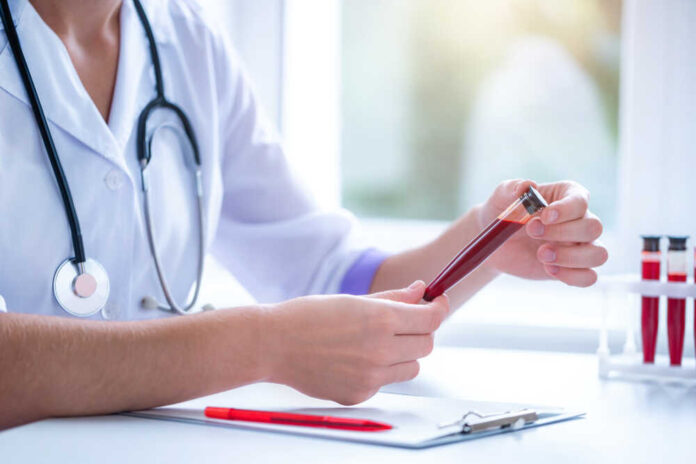 Can your blood type predict the risk of an early stroke?
